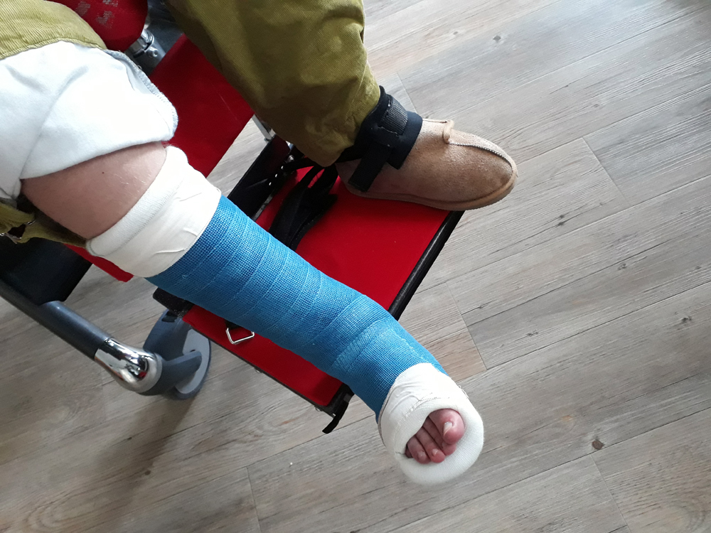 Fuß gips